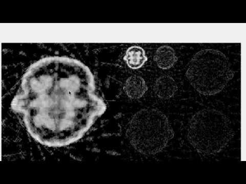 Inverse Problems Lecture