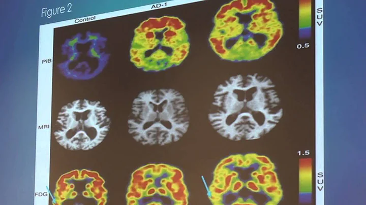 SA STGEC: Disparity Talk | McEd--AD BioMarkers (2014)