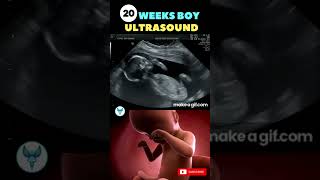 Amazing  20 Weeks baby ultrasound  Baby scan | Baby moving inside belly #pregnancy #shortsvideo