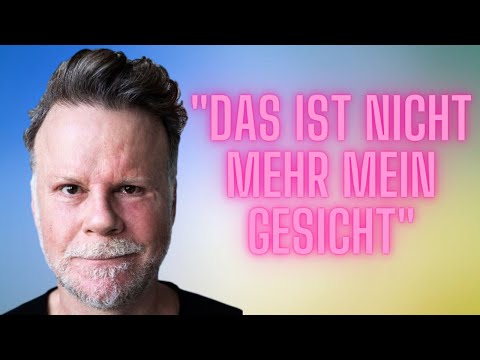 Bereut Jenke sein Schönheitsexperiment?  Jenke von Wilmsdorff