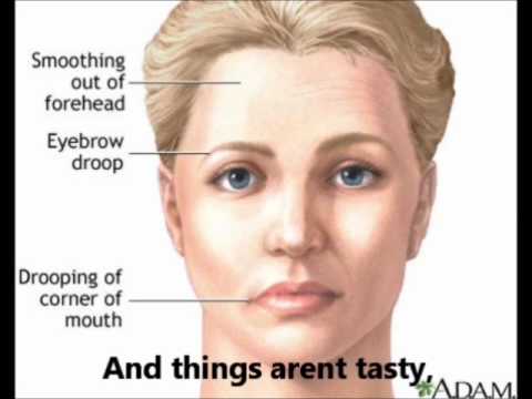 The Cranial Nerves Song - YouTube