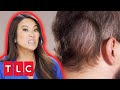 Dr. Lee Treats Groom-To-Be Who Hides His Lipoma Under A Cap 24/7! | Dr. Pimple Popper