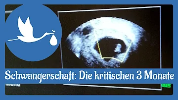 Kann man in den ersten 3 Monaten der Schwangerschaft Fliegen?