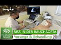 Bauchaorten-Aneurysma: Tickende Zeitbombe | Hauptsache gesund | MDR