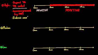 01   Tuberculosis   09   Interpreting the PPD
