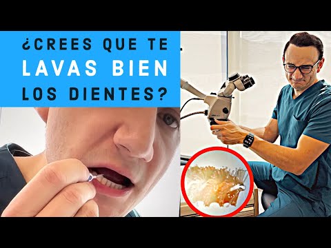 Video: ¿Usar palillos es malo para los dientes?