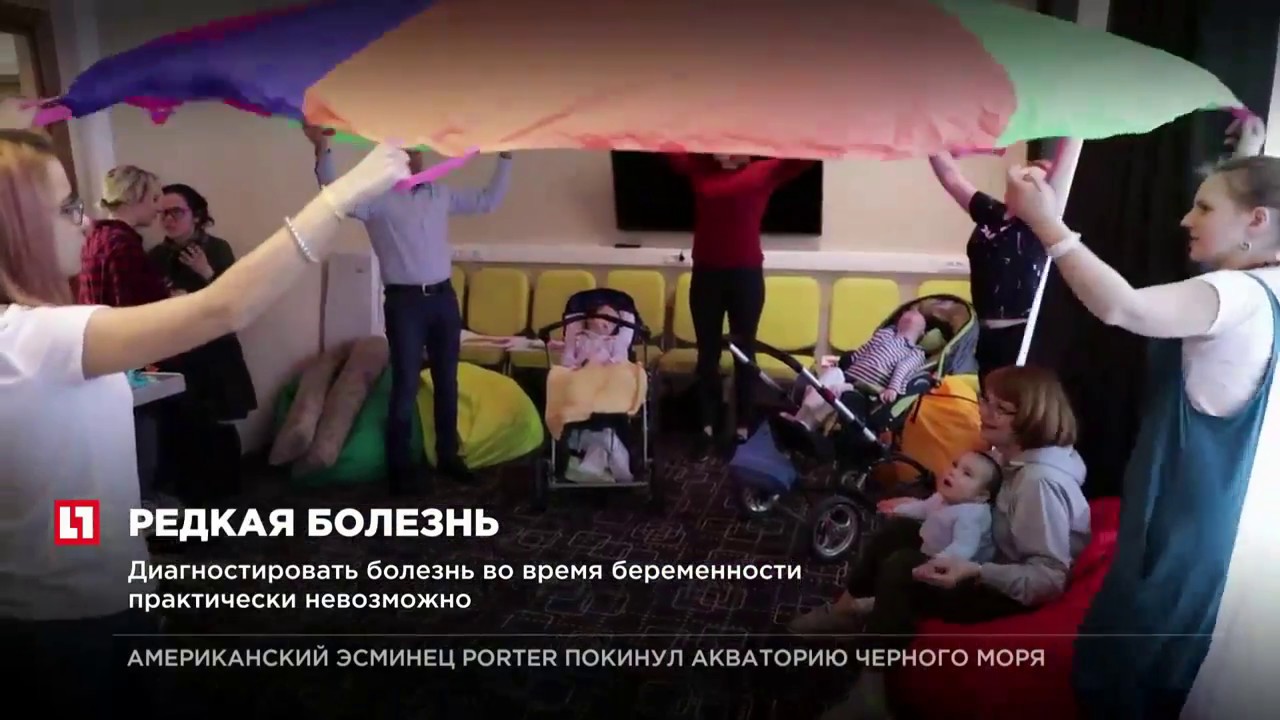 В Московской области синдромом Эдвардса есть всего у 10 детей