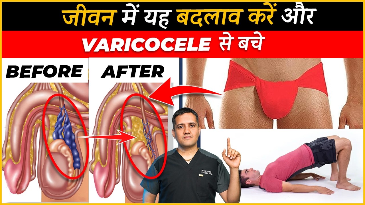 10 Lifestyle changes to stop growing varicocele | Dr. Gaurav Gangwani (Interventional Radiologist)