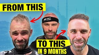 I WENT TO TURKEY FOR A HAIR TRANSPLANT!!!!  Day 1  Day 365 RAW and UNCENSORED!!!