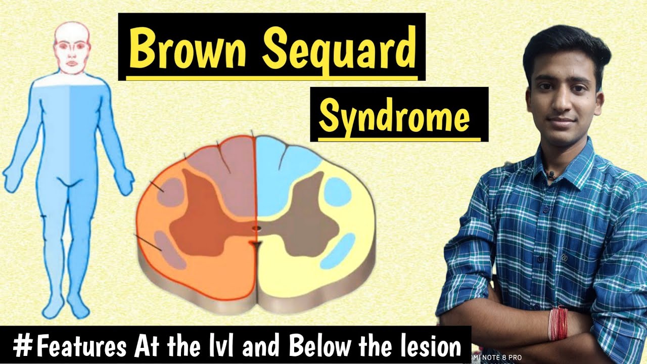 Brown Sequard Syndrome CNS Physiology Lectures MBBS hindi 
