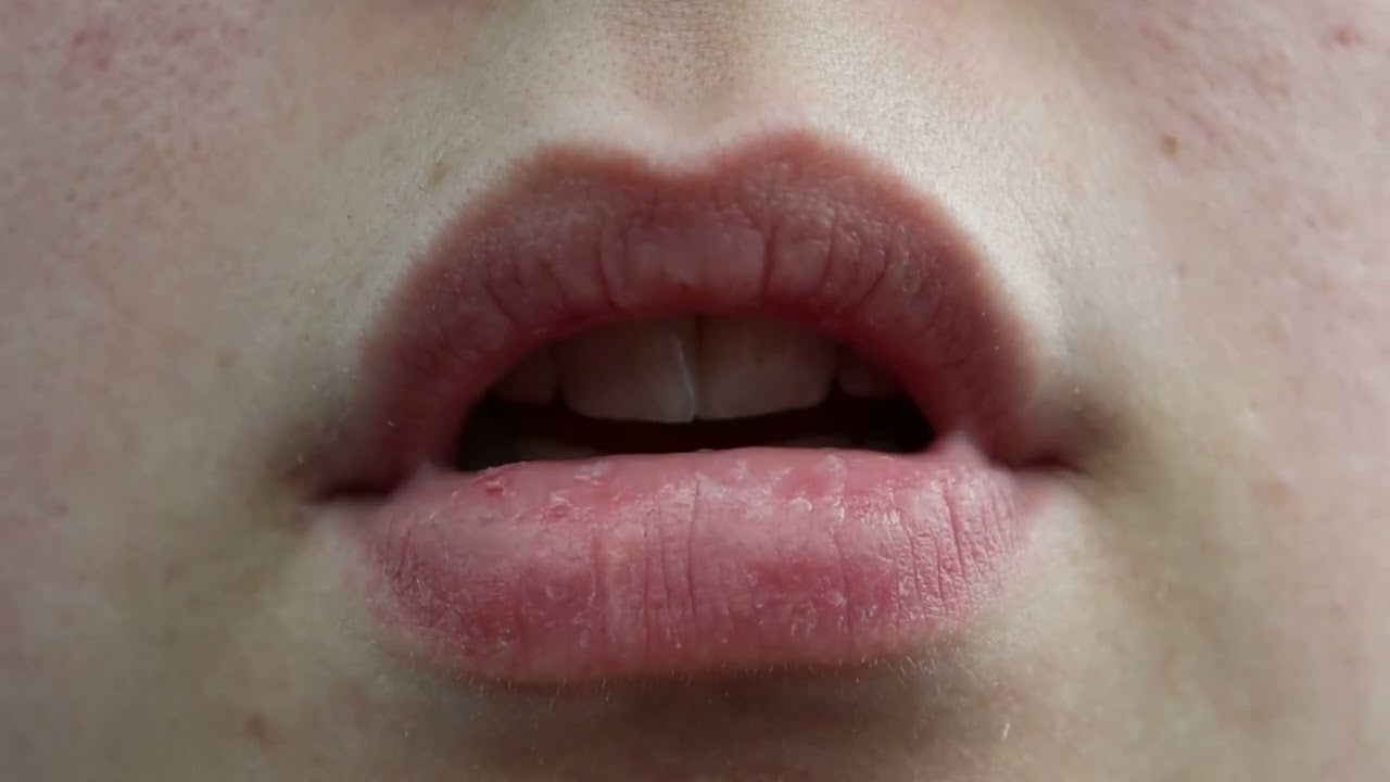 I Remember