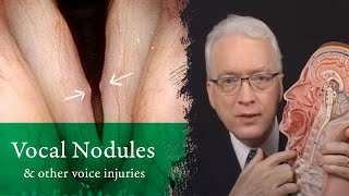 Nodules and Other Vocal Cord Injuries | How Do They Occur and Can They Be Treated?