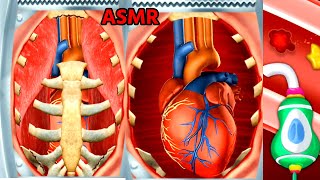 Open Heart Surgery Fixing Asmr Remove Cholesterol In Heart Vssels Byp Surgery Asmr Animation