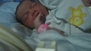 Bayi Baru Lahir Ini Sedang Memasukan Jari Ke Mulutnya Bayi Mengisap Jarinya Sendiri