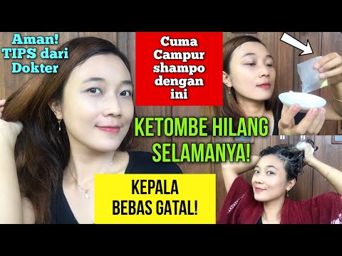 Lidah Buaya Ketombe