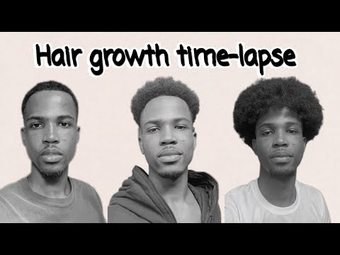 Hair Growth Time-lapse - 1 Year and 6 Months