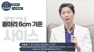 (*Eng)키수술, 하지부동, 사지연장술 발전과정 간단 정리! | 사지연장술 종류, 원리, 회복 기간