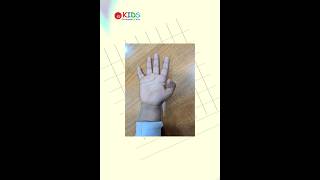 trigger thumb #kidsorthopedicclinic #soumyapaik #trigger # thumb