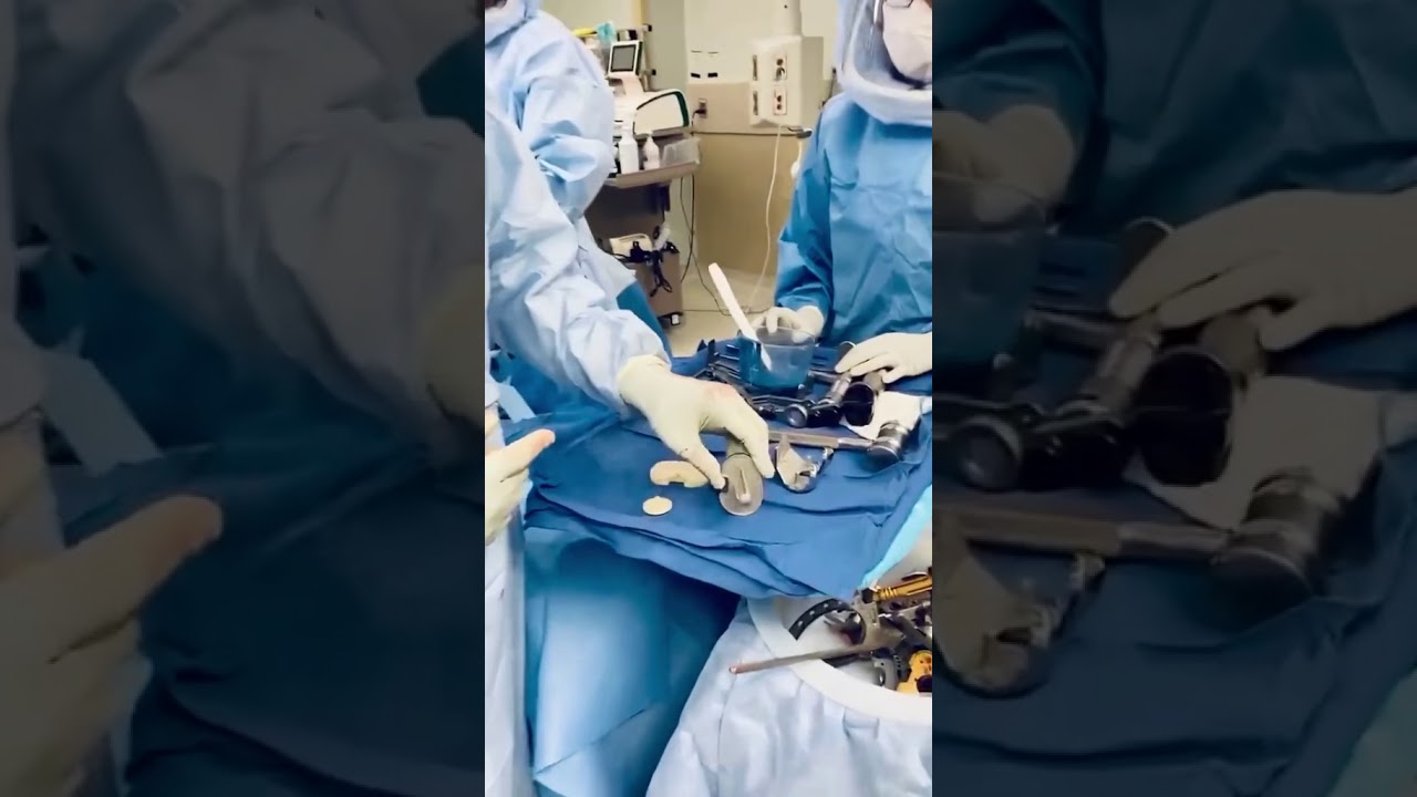 Cemented knee replacement