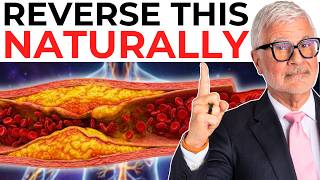 Unclog Your Arteries Naturally With These 5 Foods Recommended By A Heart Surgeon Unclog Your Arteries Naturally With These 5 Foods Recommended By A Heart Surgeon