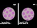 Plasmolysis Study Quiz