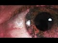 AxH - Blazing Eyes (Music Video)