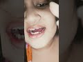 titi serong terhadap mereka