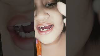 titi serong terhadap mereka