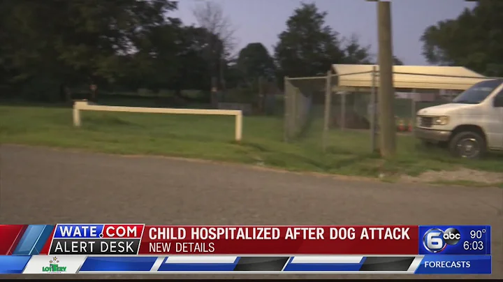 Report released after baby injured in dog attack a...