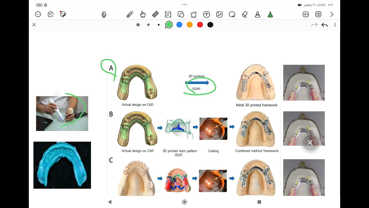 prosthodontics lec digital partial denture and rapid prototyping procedure مرحلة رابعة طب اسنان