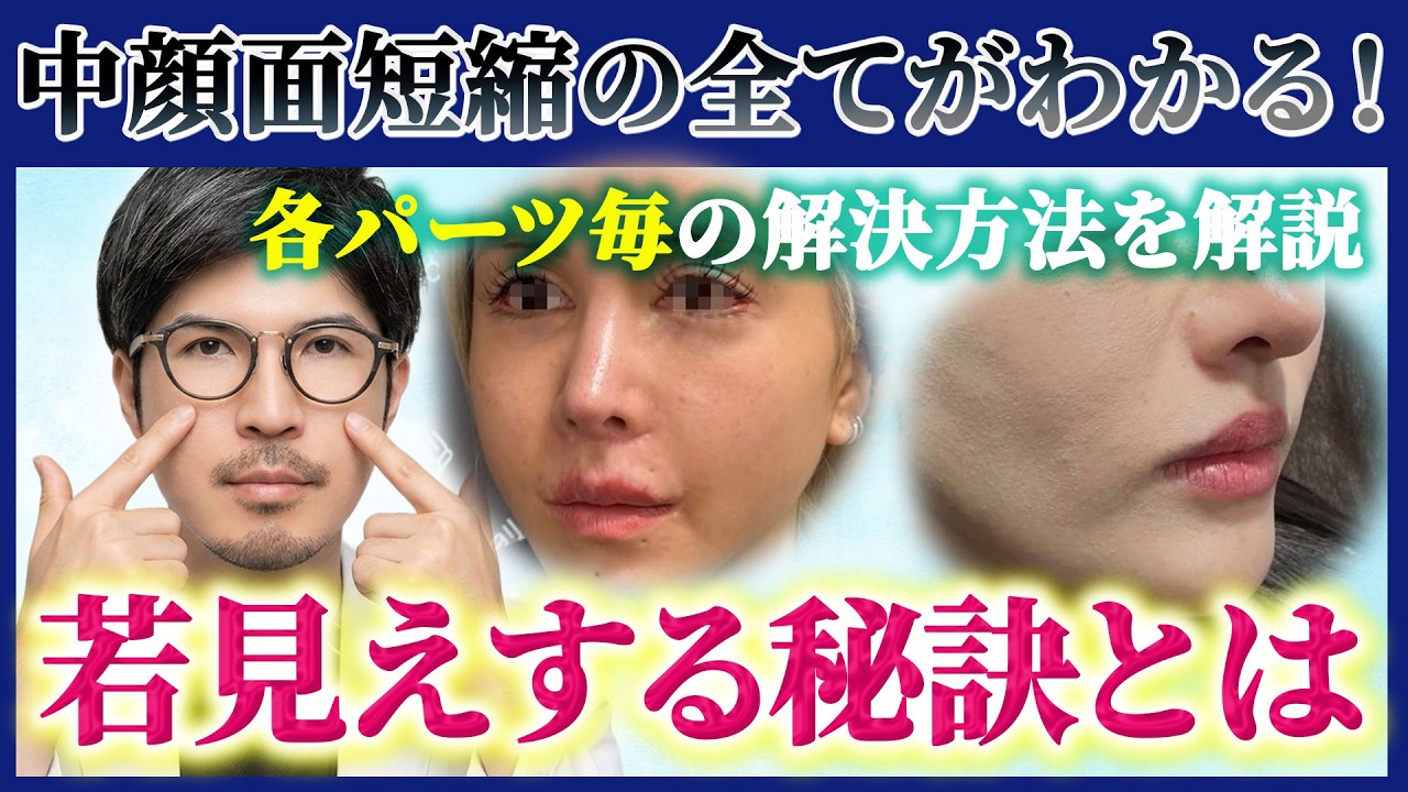 【徹底解説】中顔面短縮したいならまずはこの動画を見て