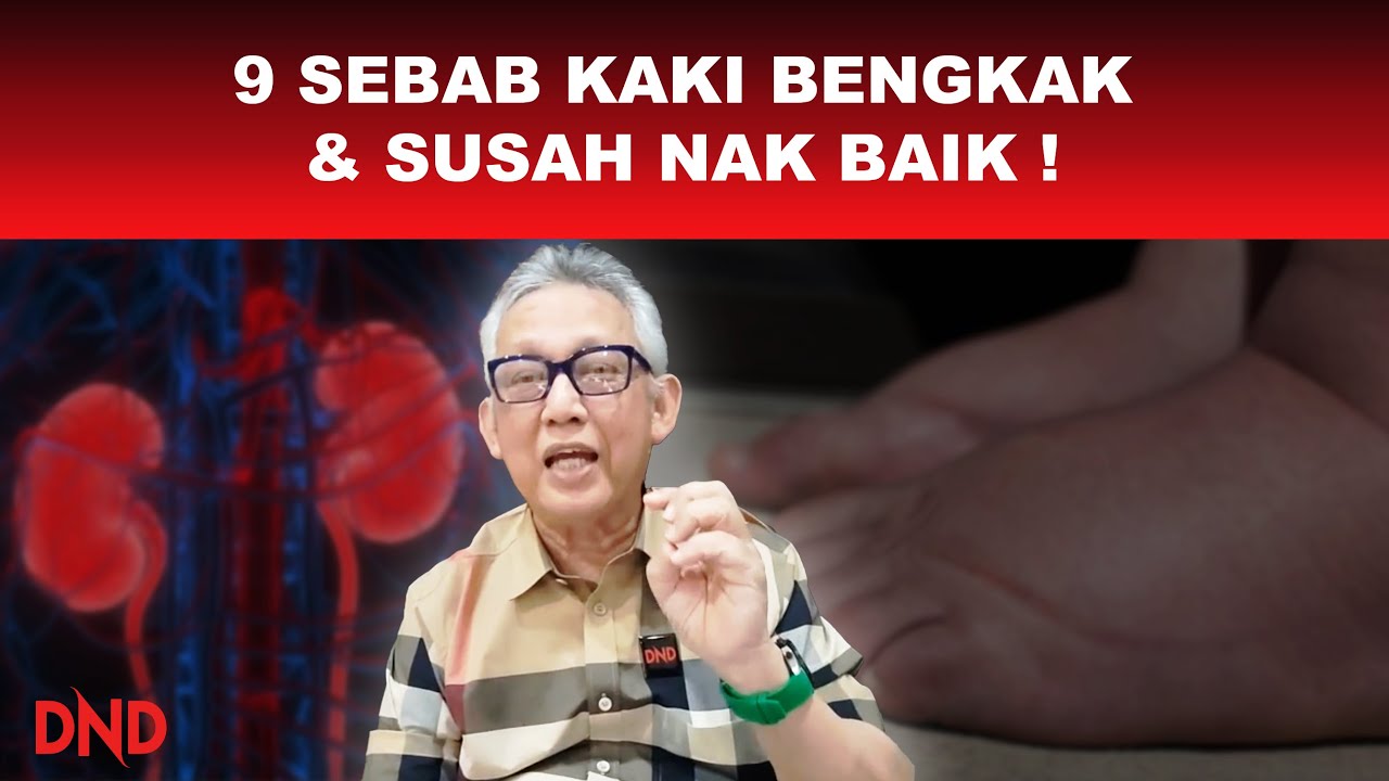 9 SEBAB KAKI BENGKAK & SUSAH NAK BAIK!
