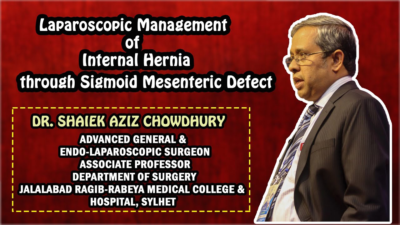 Laparoscopic Management of Internal Hernia through Sigmoid Mesenteric ...