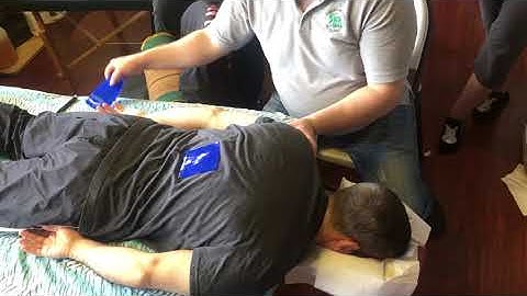 DNM: Suprascapular Nerve Buried Branches; Pencil Technique-direct pressure to AcromioclavicularNotch