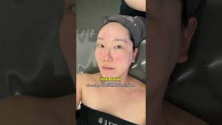 No pain Non-invasive No downtime Korean skincare treatment that I get over & over again!