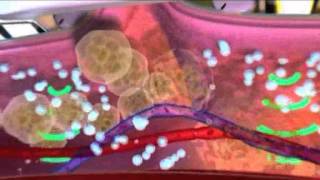 Technispa -Double Slimming- Treatment