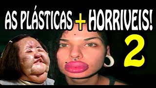 🔴 Plásticas Terríveis 2. As Plásticas que deram Totalmente Errado! PARTE 2