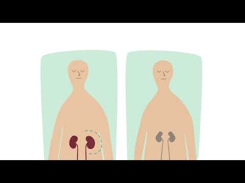El trasplantament renal
