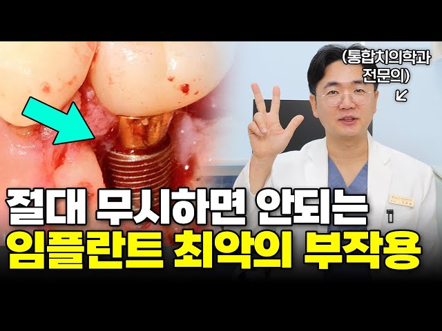 절대 무시하지마세요. 임플란트 최악의 부작용 3가지와 해결법