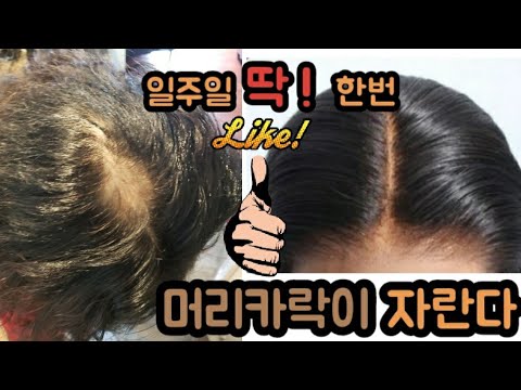 🦱일주일에 딱!!!한번씩만 바르고 자면 머리가 자란다고@@// 탈모//원형탈모//가는머리카락 고민 끝~