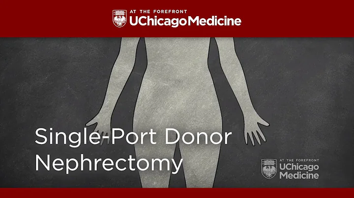 Living Kidney Donation and Transplant at UChicago ...