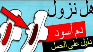 بعد أسود نزول الدورة هل أصلي دم ما سبب