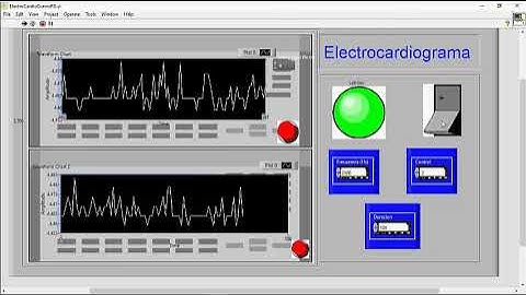 EXAMEN ABIERTO: LABVIEW Y ARDUINO ELECTROCARDIOGRAMA
