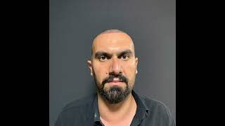 Vedat Kılıç 6700 Greft 8. Ay Sonuç