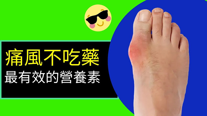 痛風 治療 【極速】舒緩關節痛方法 - 天天要聞