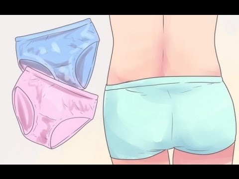 Notas y consejos sobre el flujo vaginal maloliente candidiasis symptoms