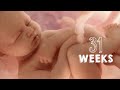 SEMANA 31 DE EMBARAZO  31 WEEKS PREGNANT  8 MESES DE ...