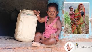 Trapped In A Babys Body 50 Years Old Man Is Forever Young Body Bizarre Part 1