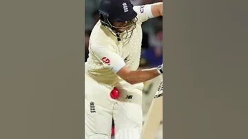 Importance of Cricket Guards 😨 | #shorts