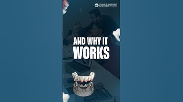 Why are your Implants FAILING? | Socket Shield Technique #dentist #socketshield #smilemakeover